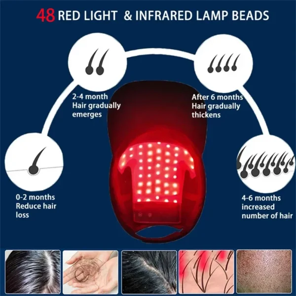 48 Leds Hair Growth Red Light Therapy Cap Red&blue Light Infrared Light Therapy Device for Prevents Hair Loss and Hair Growth - Image 5