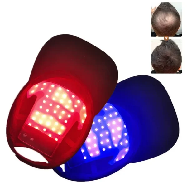 48 Leds Hair Growth Red Light Therapy Cap Red&blue Light Infrared Light Therapy Device for Prevents Hair Loss and Hair Growth - Image 2